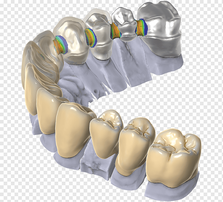 3D Printing: CAD/CAM systems